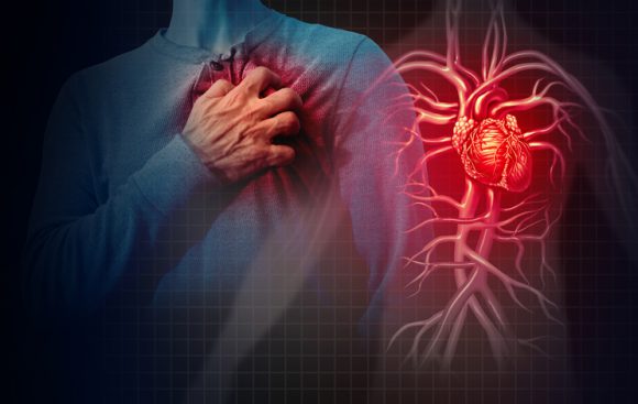 심장마비 생존자 ‘이것’만 잘 지키면 7년 더 산다(연구)