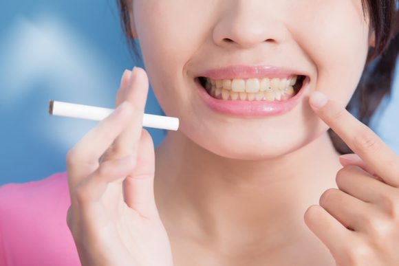 치과의사의 당부 “임플란트 후 절대 금연”