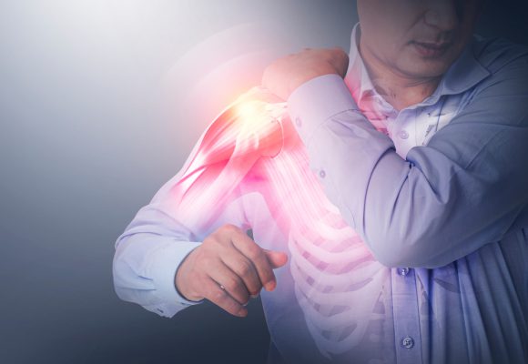 지속되는 어깨 통증… ‘어깨 관절염’ 주의