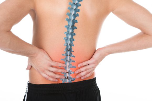﻿뼈가 휘는 ‘척추측만증’ 개선하는 운동법