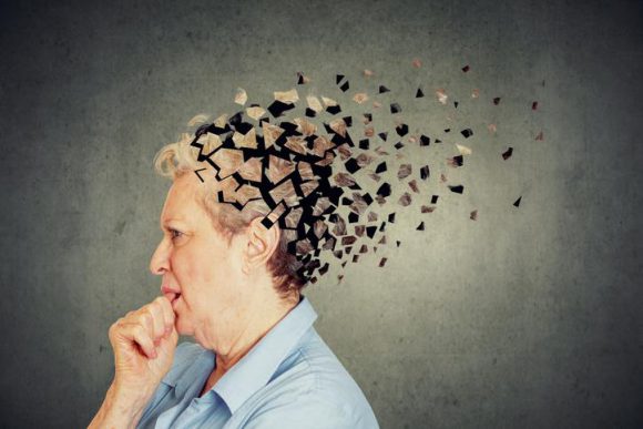﻿알츠하이머와 다른 유형의 치매 종류 4가지