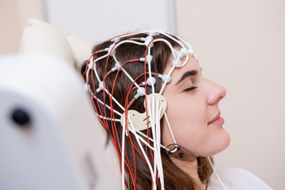 Electrical brain stimulation enhances memory for 1 thirty day period (analyze)