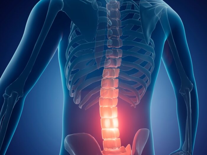 ﻿허리 아프면 찜질?… 잘못된 척추 관절 속설 5