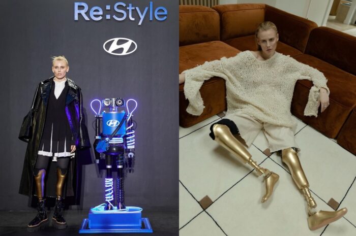미국 패션모델 두 다리 앗아간 ‘독성쇼크증후군’이란?