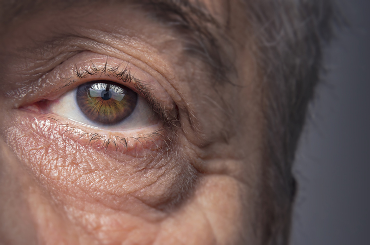 Can you tell if you have Alzheimer’s by looking at your eyes?