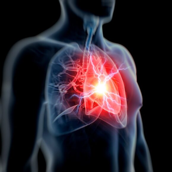 ﻿사망원인 2위… ‘심장병’ 이상 징후와 예방법 5