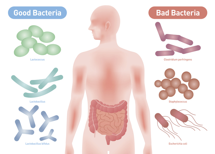 Gut Bacteria Linked to Arterial Blockage: Streptococcus Genus Implicated