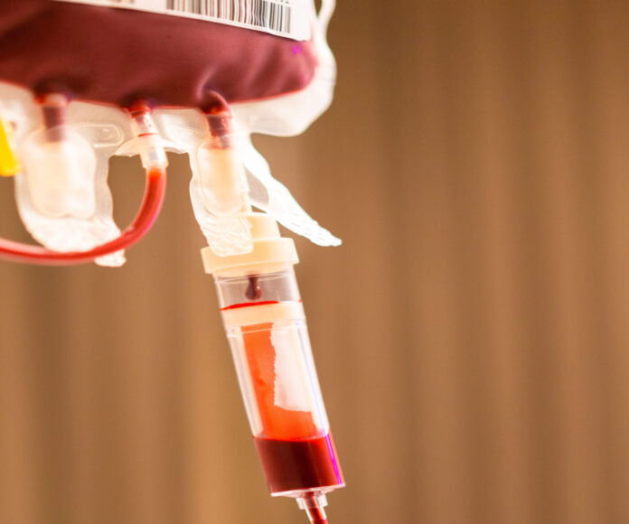 “수술 시 수혈 최소화해야”…수혈량에 따른 합병증 위험도 규명