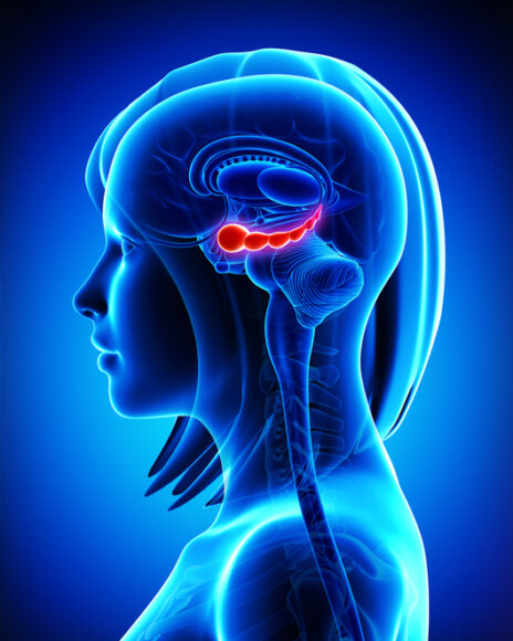 뇌의 ‘이 부위’ 잘 살피면…치매 20년 전 진단 가능