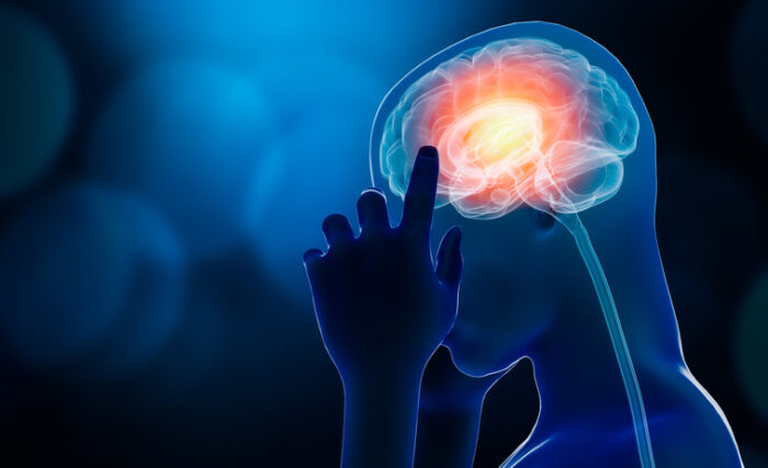 뇌전증약 ‘토피라메이트’ 국제 권장량 20%로 충분
