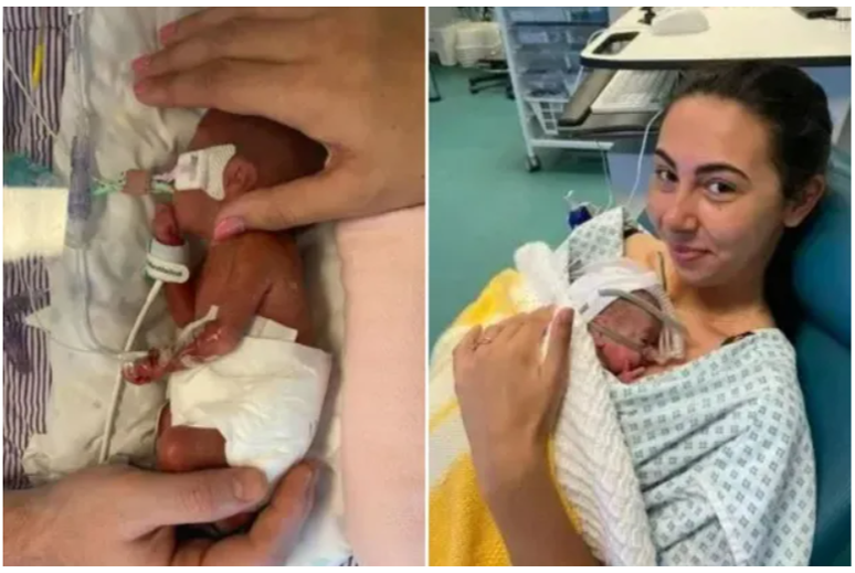 British Woman Gives Birth to 0.5 kg Son After 22 Weeks of Labor – Miraculous Survival Story