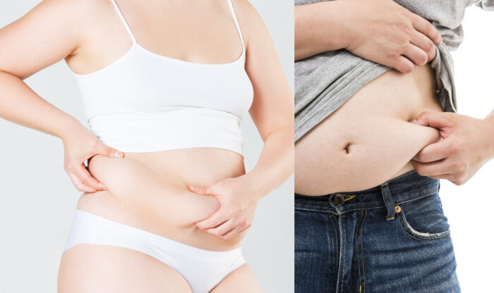 물렁vs딱딱 뱃살...배에 쌓인 '지방'에 따라 다르다? - 코메디닷컴