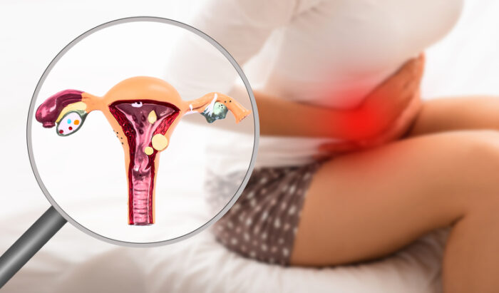 “참을 수 없는 고통”…자궁내막증, ‘이 운동’으로 치료한다?
