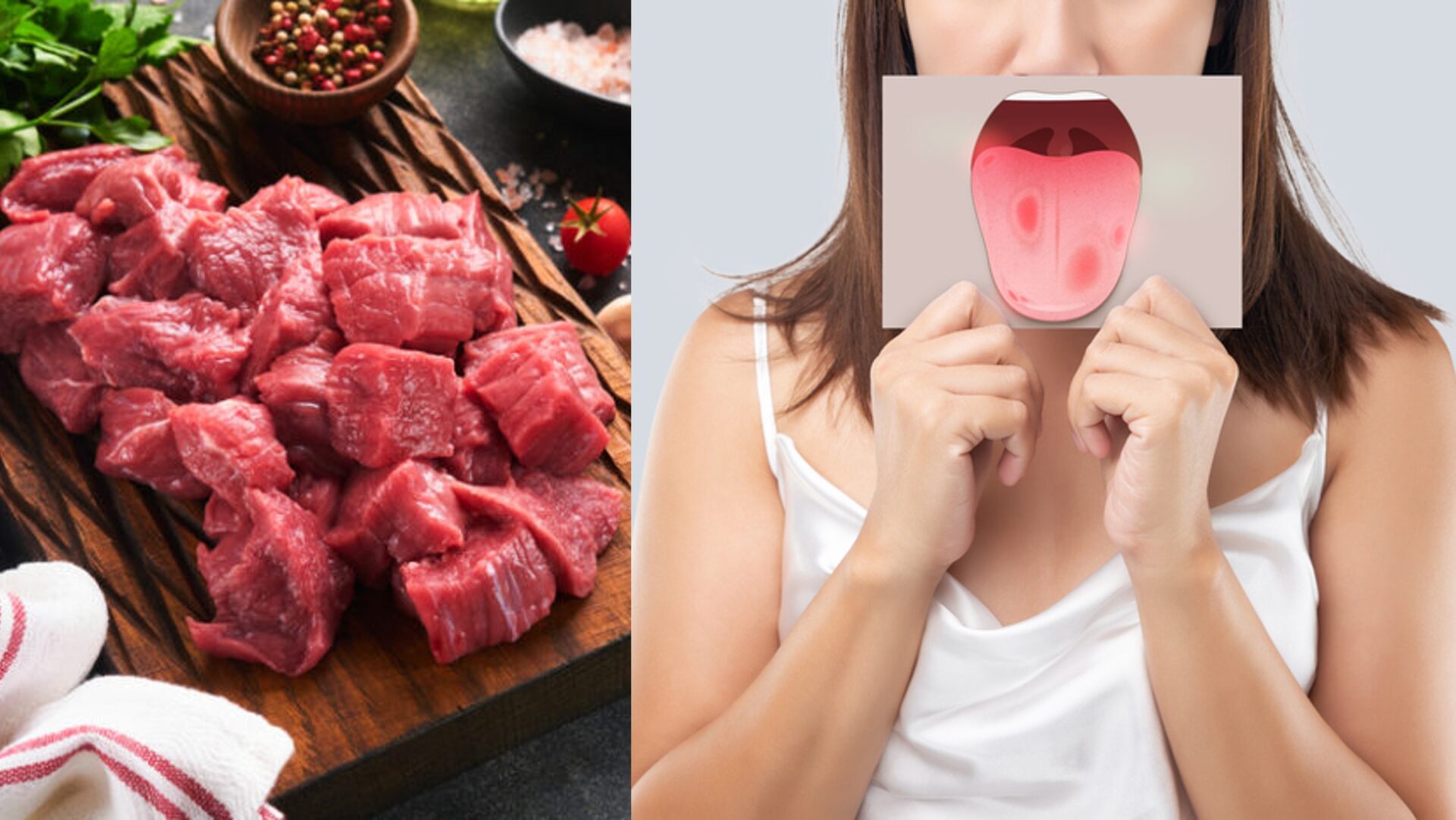 (완)고기 많이 먹으면 ‘입’도 비상…구강암 위험 증가