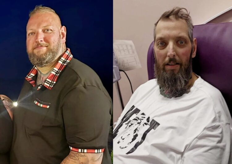 40-Year-Old Loses 35kg in 5 Months, Misdiagnosed with Cancer as Constipation - News Directory 3