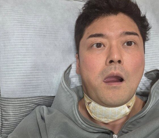 Jeon Hyun -Moo「声が出てこない」…顔への土の光は「これ」ですか？