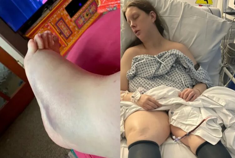 « Une partie du fœtus reste dans l’estomac pendant 9 semaines après une fausse couche »… Qu’est-il arrivé à la femme qui a failli mourir lorsque le médecin l’a laissée seule ?