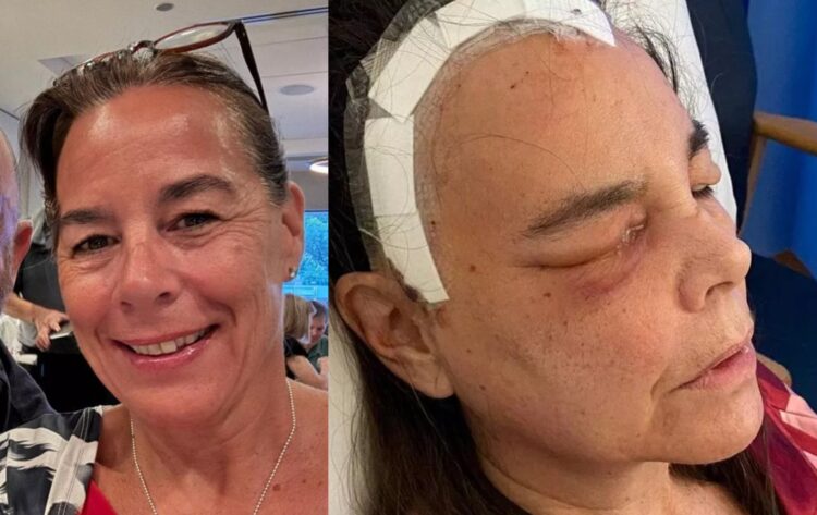 grippe? Ménopause? Je suis restée au lit pendant 2 ans sans en connaître la cause… Femme d’une cinquantaine d’années, enfin diagnostiquée avec « cette maladie », que s’est-il passé ?