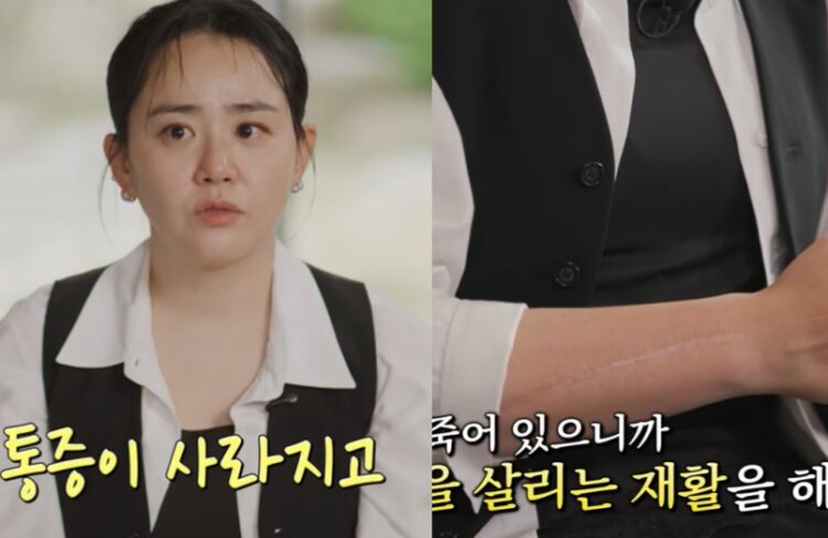 문근영이 겪은 '급성구획증후군', 골든타임 놓치면 절단까지?