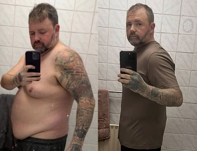 비만 주사의 두 얼굴, 40kg 감량 뒤 찾아온 담낭염의 비극