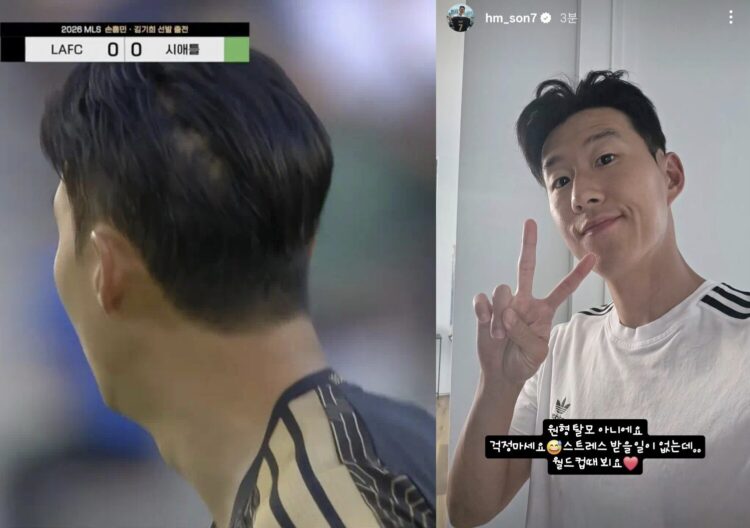 Son Heung-min sale al paso de los rumores sobre «esto»: «No es alopecia areata. No os preocupéis»