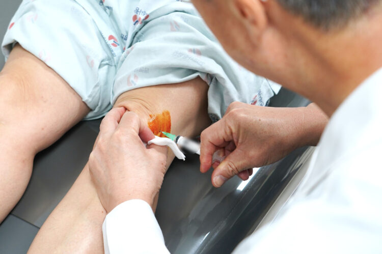 Quiere retrasar la prótesis de rodilla: la terapia SVF reduce el dolor en tres semanas