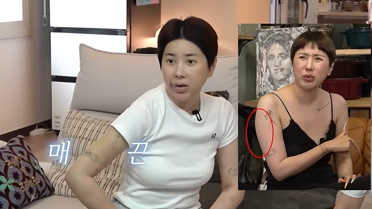 “15kg 뺐는데도 안 빠졌다” 서인영, 팔에 시퍼런 멍…무슨 일?