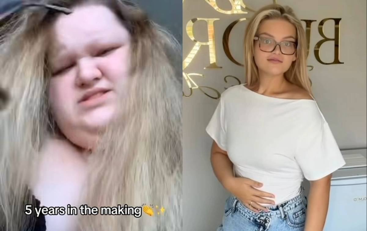“같은 사람 맞아? 155kg 감량 성공”…英 29세女, 어떻게 뺐나 봤더니?