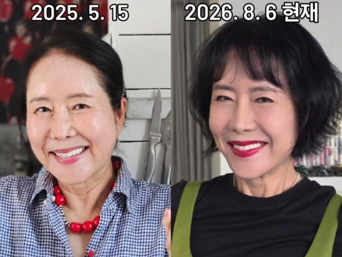 “확 달라졌네” 64세 윤영미, 1년 만에 딴사람…‘이 수술’ 효과 이 정도?
